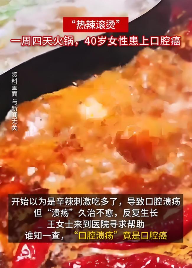 一周4天火锅40岁女子患口腔癌火锅爱好者口中白斑一查是口腔癌