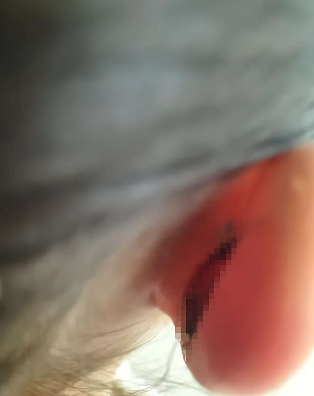 一年级女生课堂上“走神”，被老师揪伤耳朵缝5针；教育局：涉事者已被停课