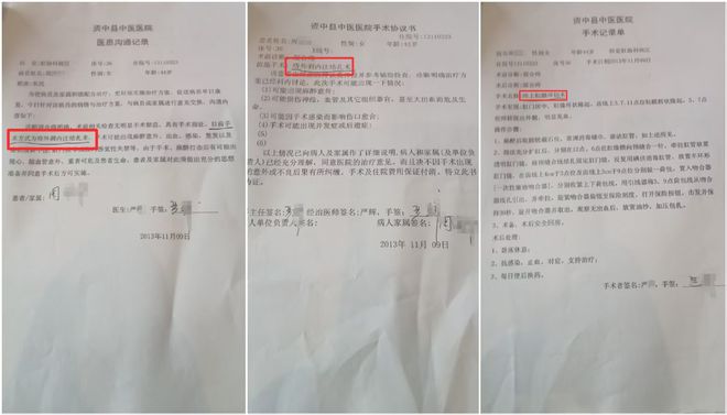 女子做痔疮手术留“隐患”：10年8次手术取出30多枚钛钉；法院判赔62万