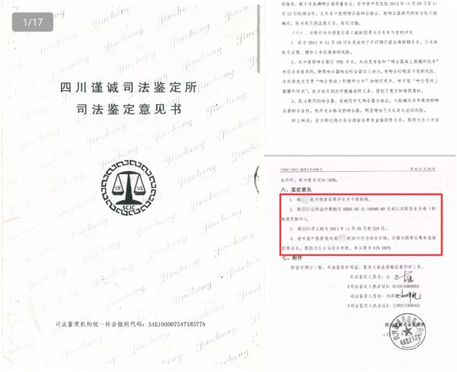 女子做痔疮手术留“隐患”：10年8次手术取出30多枚钛钉；法院判赔62万